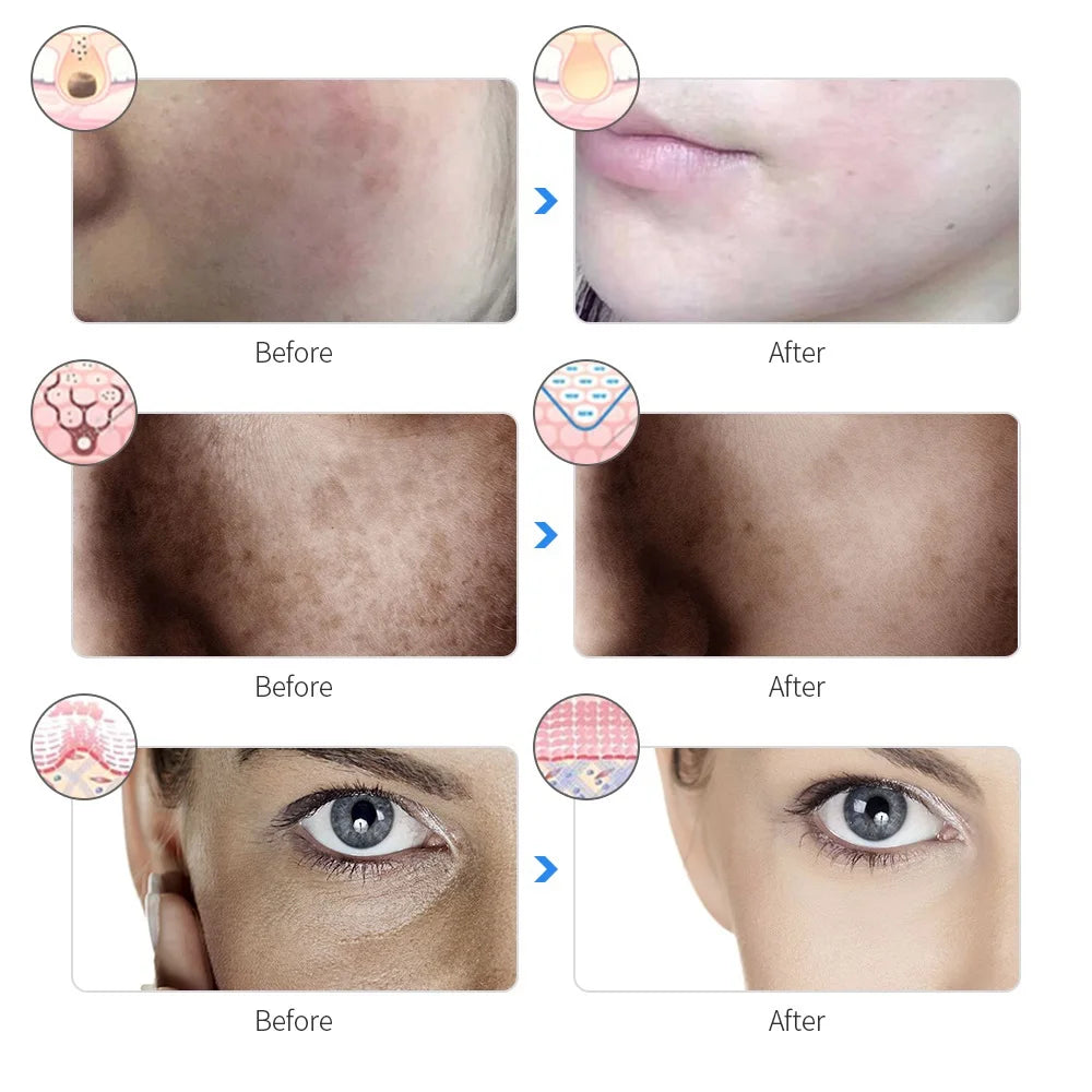 LumaGlow™ 7-Light Skin Renewal Mask