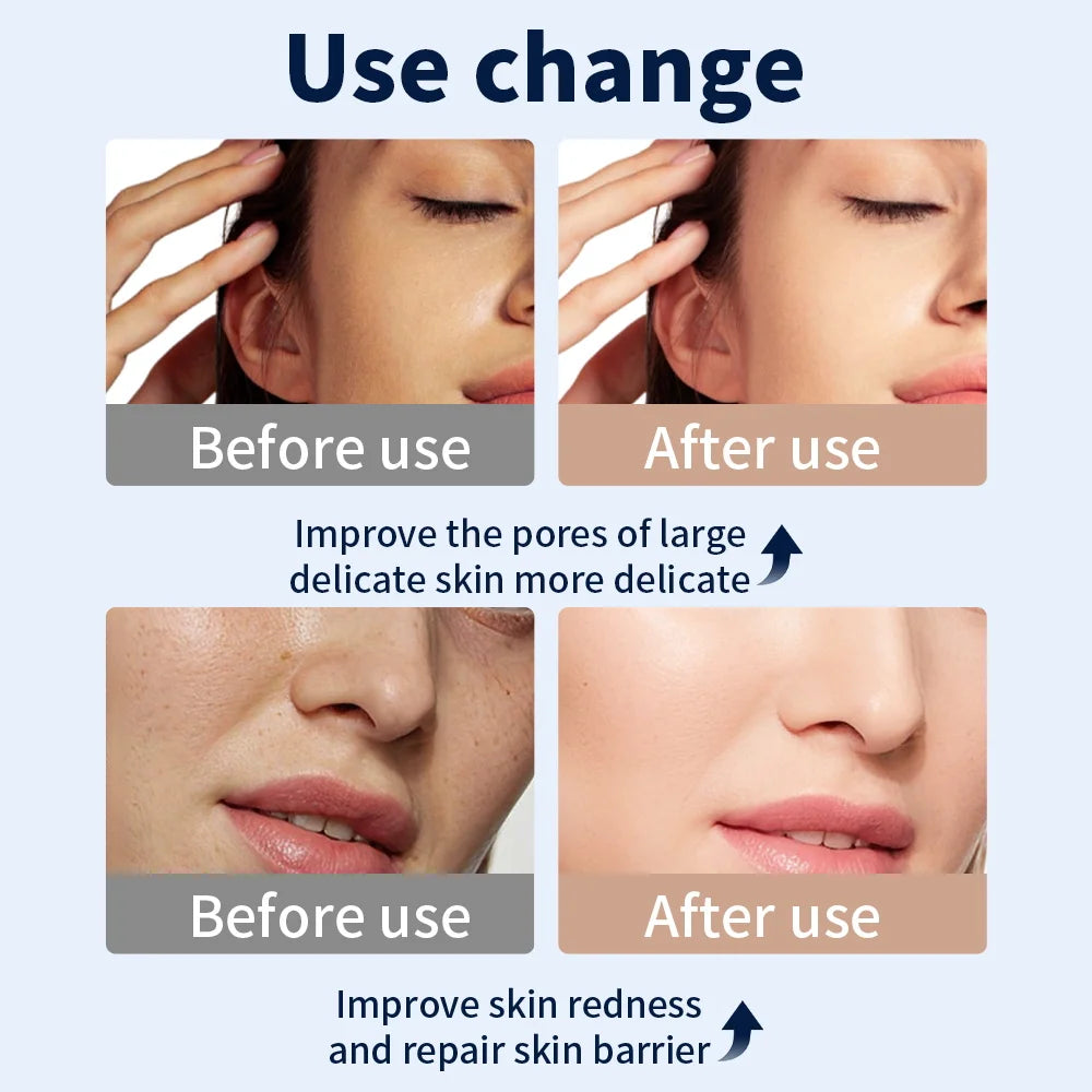 NeckLuma™ Full-Face & Neck Light Therapy Mask