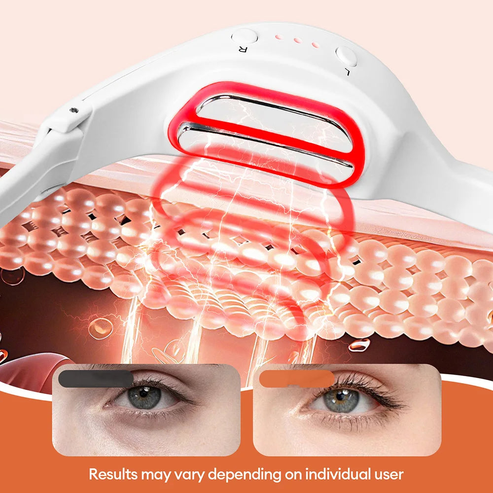 EyeCalm™ EMS Eye Relief Massager
