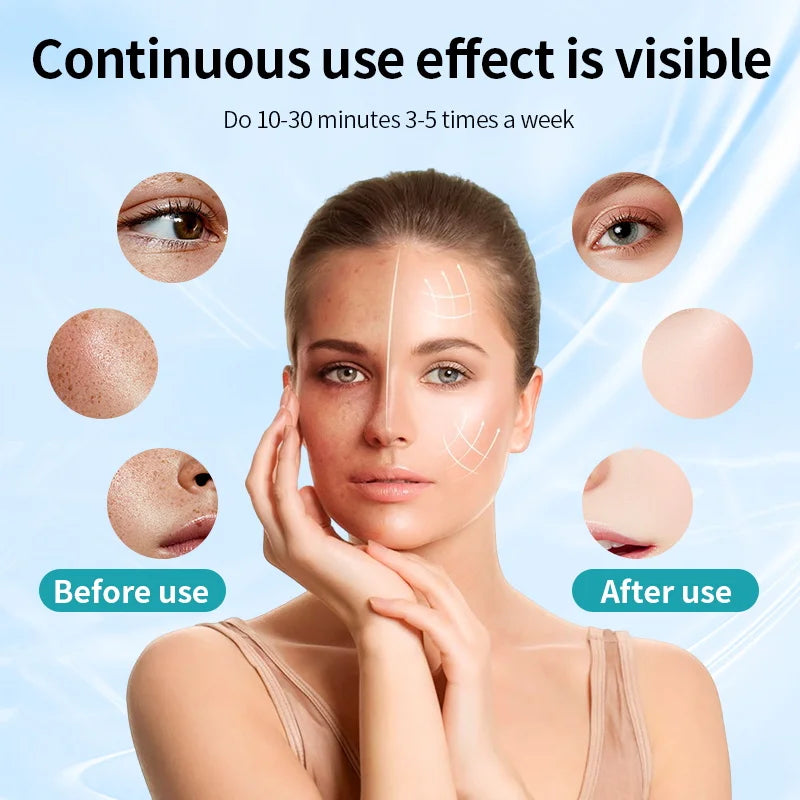 NeckLuma™ Full-Face & Neck Light Therapy Mask